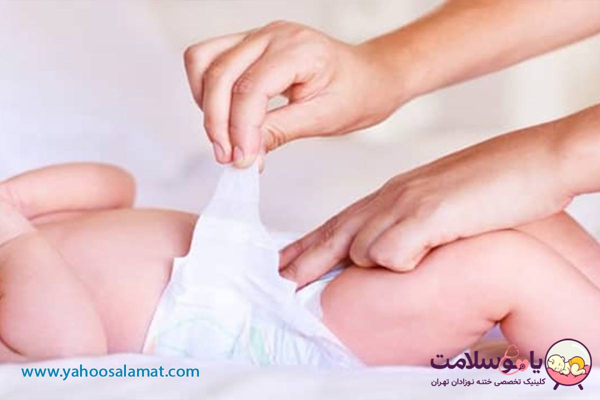 روش های ختنه کردن نوزاد روشهای مراقبت پس از ختنه