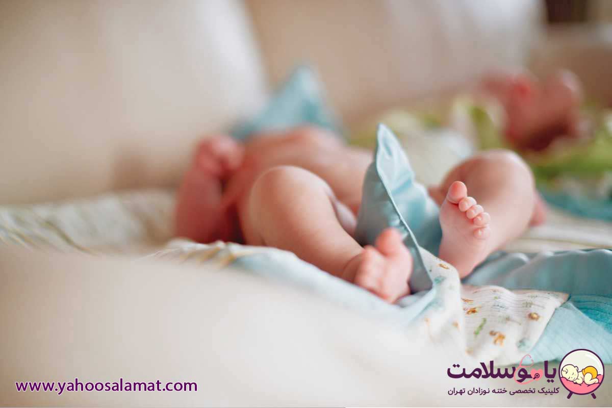 ختنه نوزاد با حلقه بهتر است یا بخیه بهترین دکتر بخیه در تهران