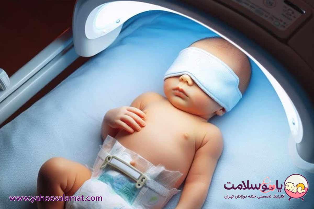 دستگاه درمان زردی نوزاد در تهران اجاره دستگاه با قیمت مناسب