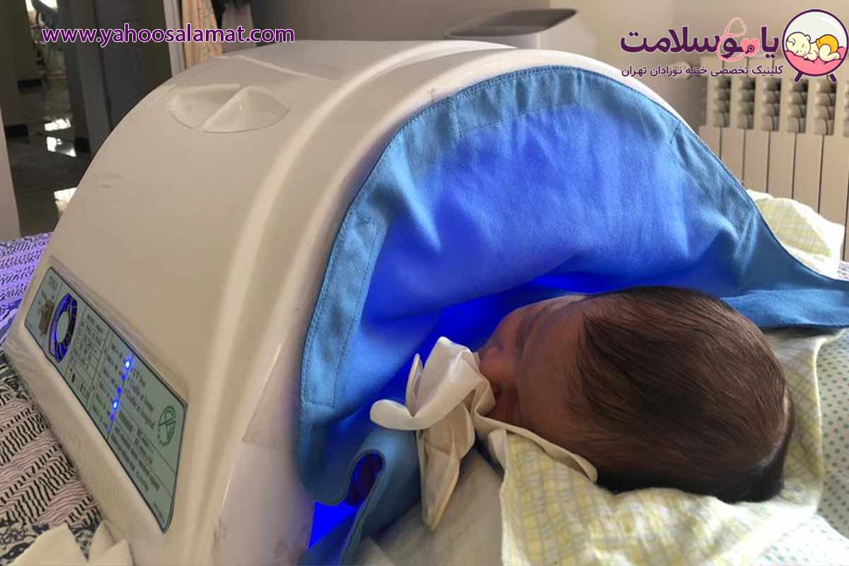 دستگاه درمان زردی نوزاد در تهران مزایای اجاره دستگاه