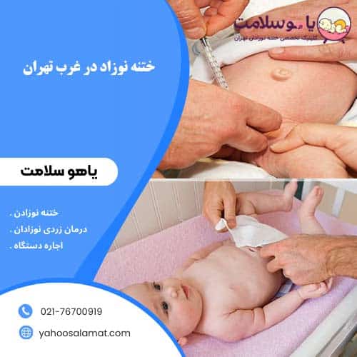 ختنه نوزاد در غرب تهران یاهوسلامت